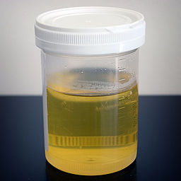 256px-Urine_sample